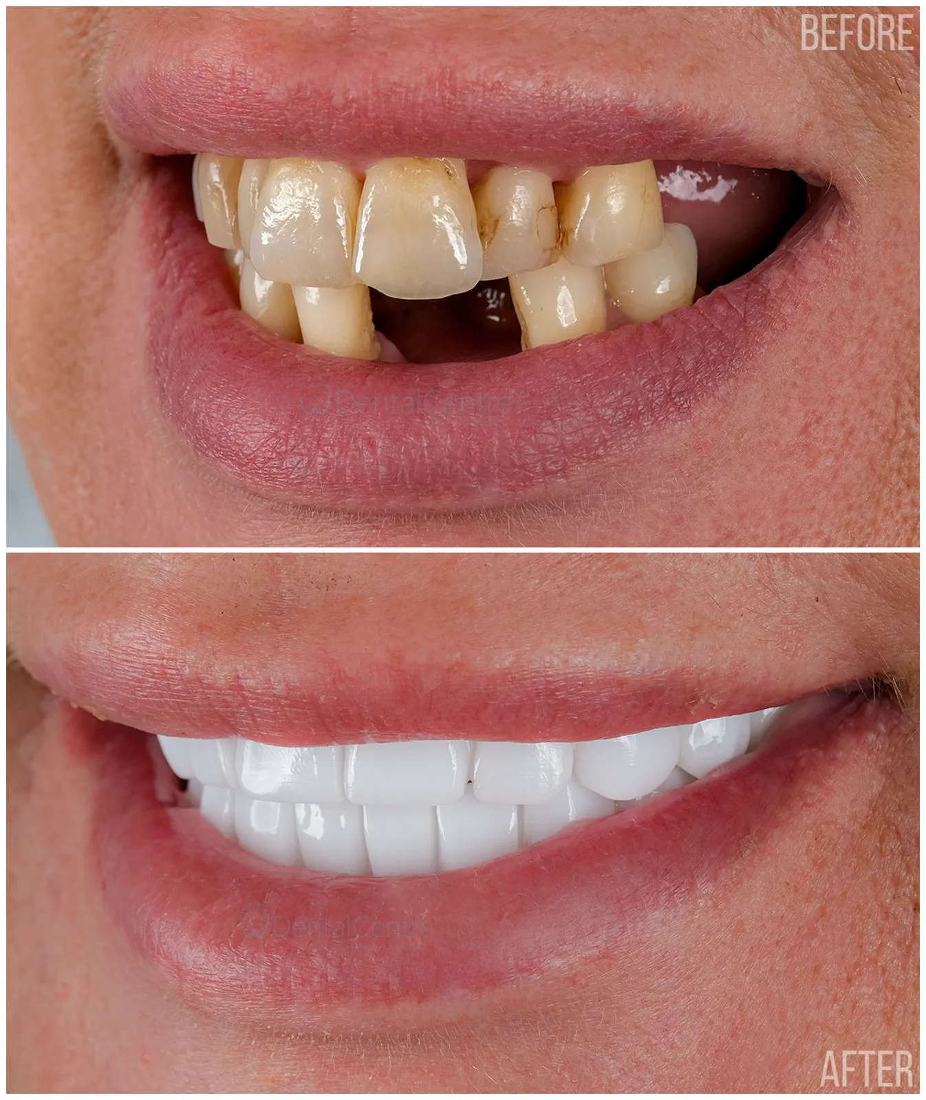 After - Clinical Result